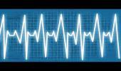 Embedded thumbnail for Speed gets the heart pumping....... until it stops it